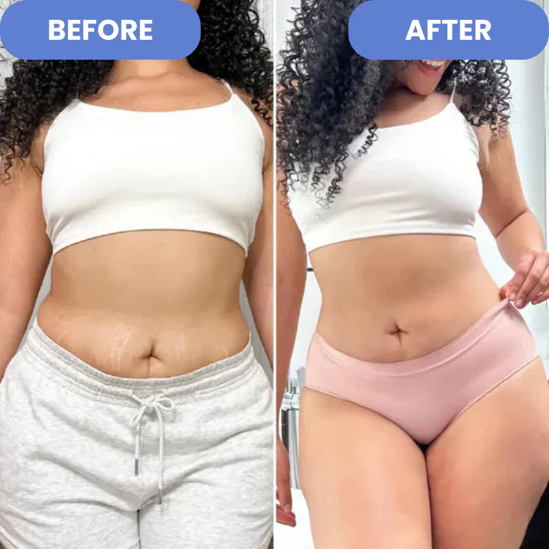 ProSculpt™  - Cellulite Treatment 4-in-1 -EBOOK GRATUITO DE REGALO