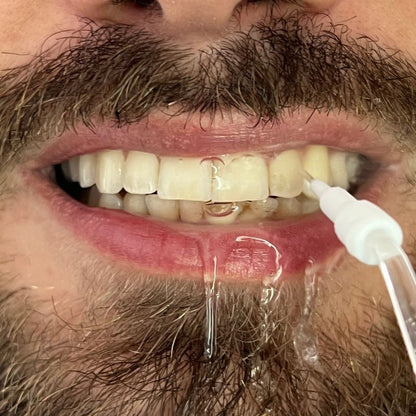 VitallyPRO-Irrigador bucal supersónico para una limpieza profunda con chorro de agua