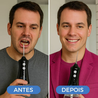 VitallyPRO-Irrigador bucal supersónico para una limpieza profunda con chorro de agua